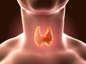 thyroid surgery