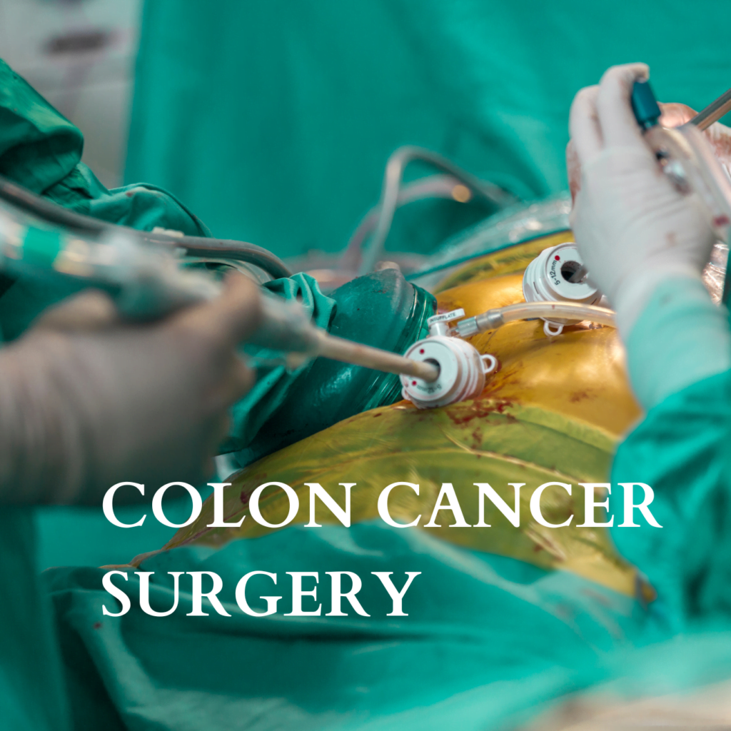 Recovery Period After Colon Cancer Surgery