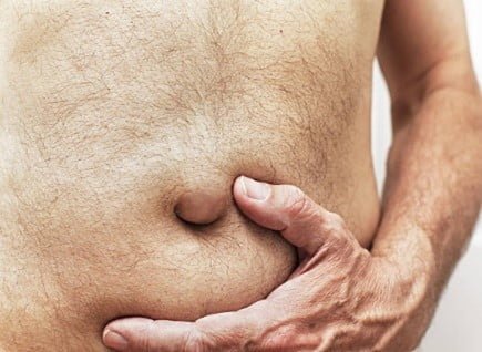 Umbilical Hernia: Symptoms, Treatment, and Recovery Guide