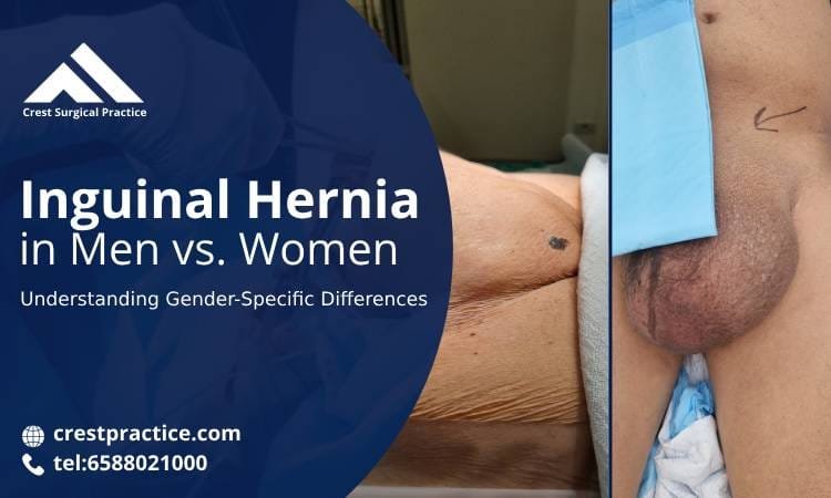 Inguinal Hernia in Men vs. Women