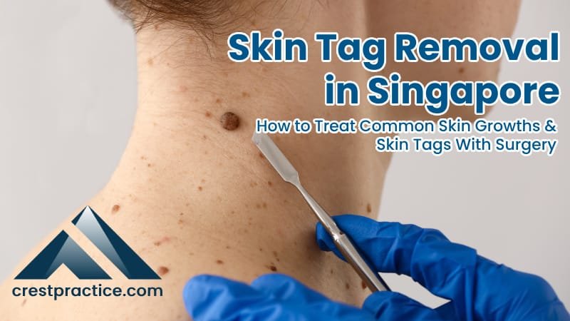 Skin Tag Removal