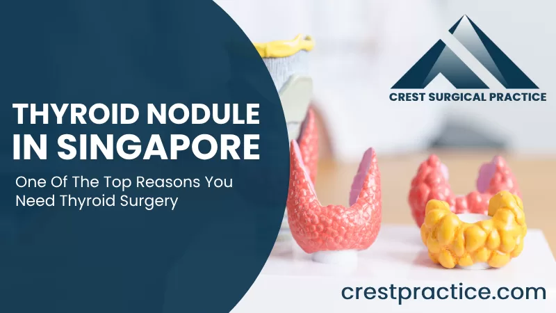 thyroid nodule Singapore