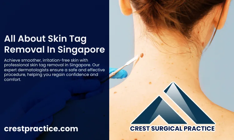 Skin Tag Removal In Singapore