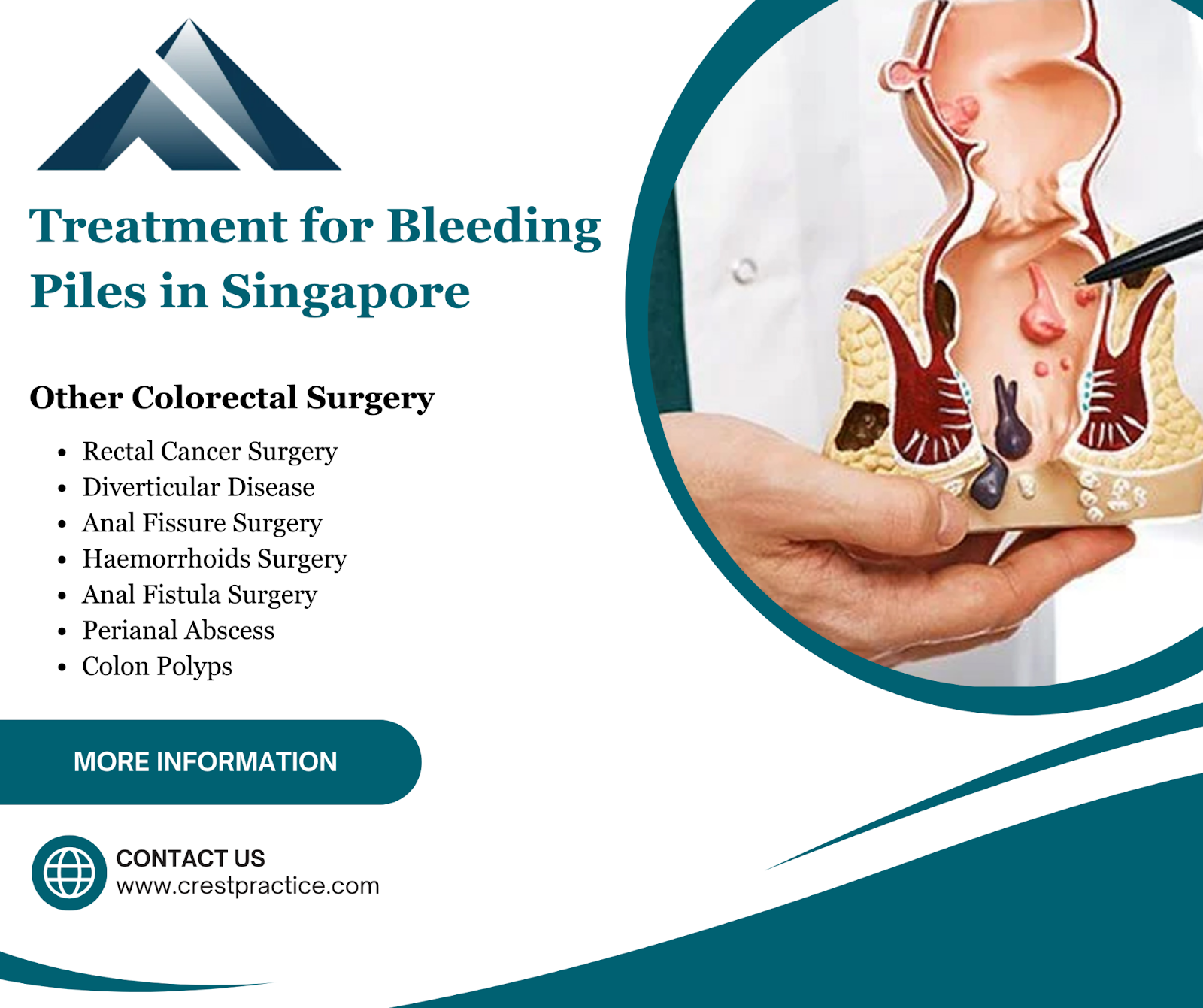 treatment for bleeding piles in Singapore