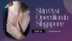Skin Cyst Operation