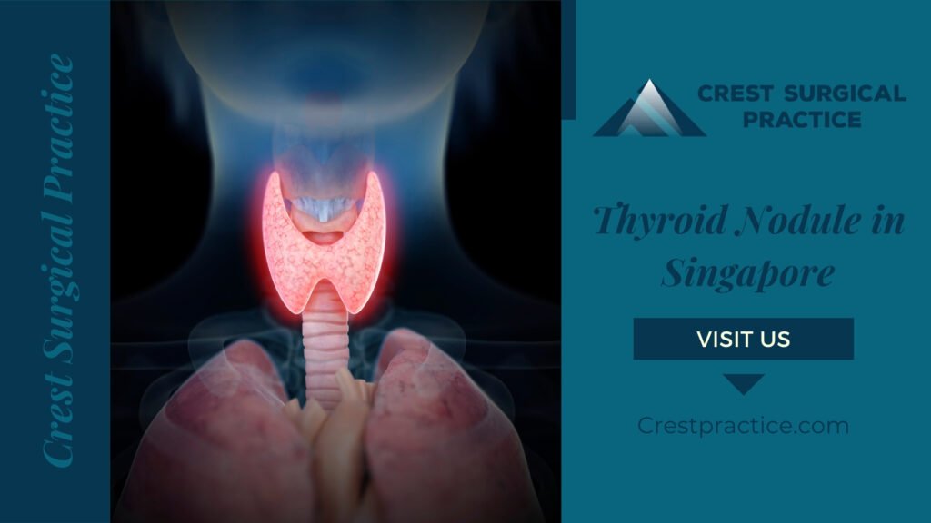 Thyroid Nodule