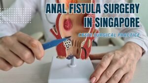 Anal fistula surgery