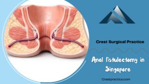 Anal fistulectomy