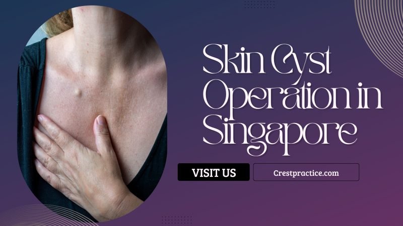 Skin Cyst Operation