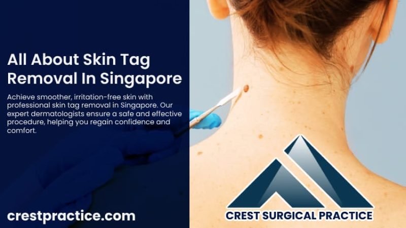 Skin Tag Removal In Singapore