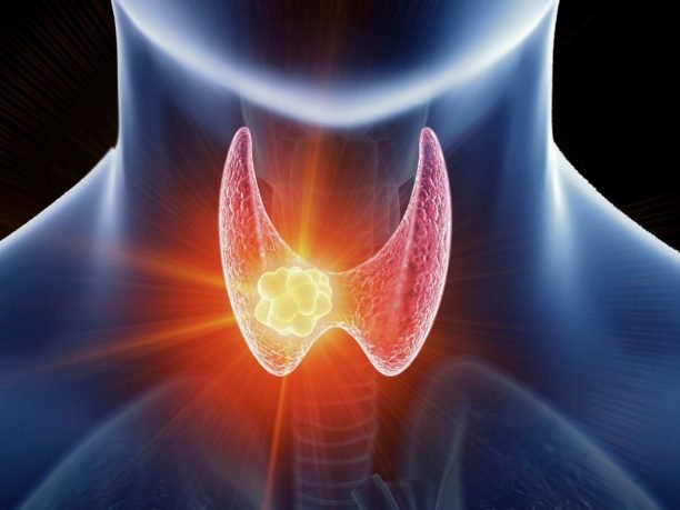 Thyroid surgeon in Singapore