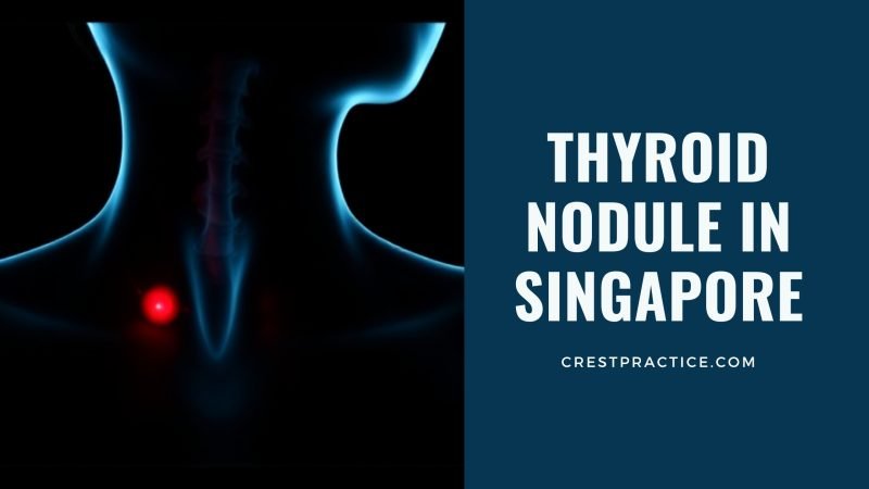 Thyroid Nodule in Singapore